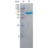 sp-pme c100045 nectin 4 sp1