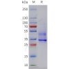sp-pme c100088 cxcr2 sp1