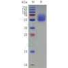 sp-pme c100125 il1rl2 sp1