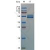 sp-pme d100001 il18bp sp1