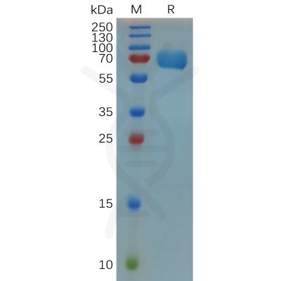 sp-pme m100013 trop2 sp1