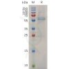 sp-pme m100031 mmp13 sp1