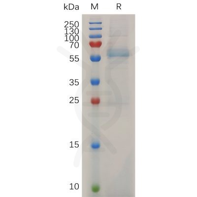 sp-pme m100031 mmp13 sp1