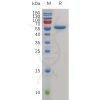 sp-pme m100042 cd40 sp1