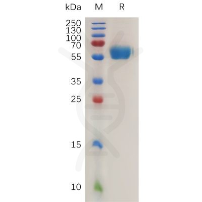 sp-pme m100069 ror1 sp1