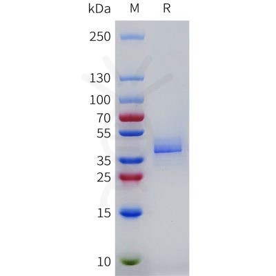 sp-pme m100125 cxcr2 sp1