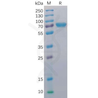 sp-pme100015 cd40 sp1