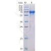 sp-pme100022 ox40 sp1