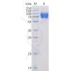 sp-pme100024 slamf1 sp1