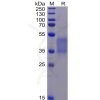 sp-pme100069 fcgr3a sp1