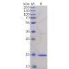 sp-pme100076 tnfa sp1