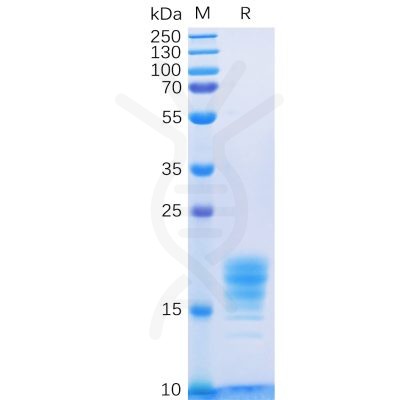 sp-pme100085 il5 sp1