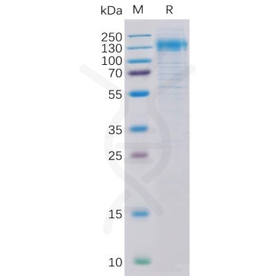 sp-pme100095 her2 sp1