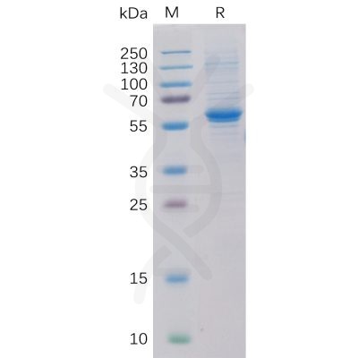 sp-pme100097 ror2 sp1