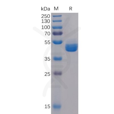 sp-pme100107 tigit sp1