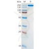 sp-pme100134 alk sp1