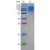 sp-pme100262 gucy2c sp1