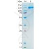sp-pme100390 psma sp1
