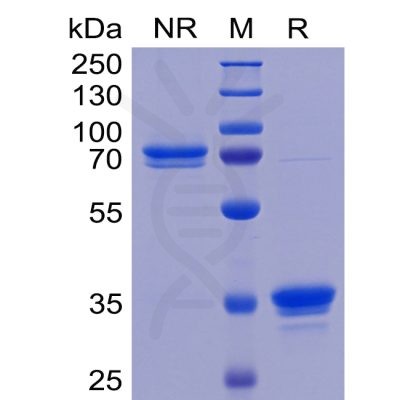 sp-pme100463 tweakr sp1