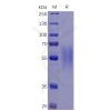 sp-pme100468 il17ra sp1