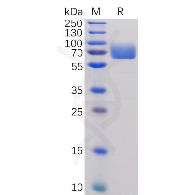 sp-pme100473 b7 1 sp1
