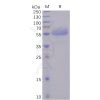 sp-pme100484 icos sp1