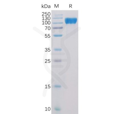 sp-pme100490 ace2 sp1