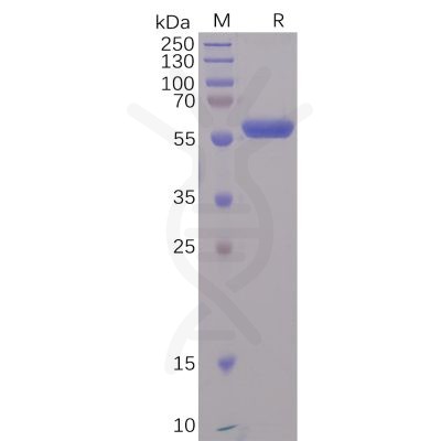 sp-pme100497 rbd sp1