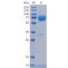 sp-pme100501 trop2 sp1