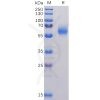 sp-pme100504 nucleocapsid sp1