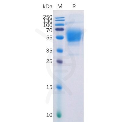 sp-pme100507 cb1 sp1