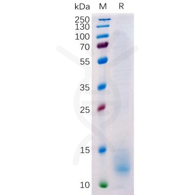 sp-pme100511 bcma sp1