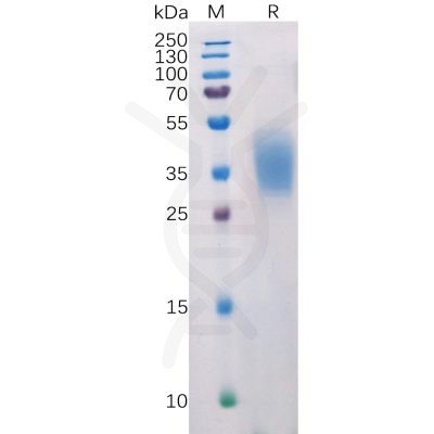 sp-pme100518 pdl2 sp1