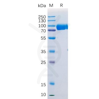 sp-pme100531 sirpa sp1