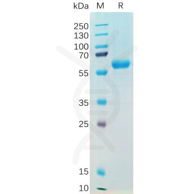 sp-pme100543 s protein rbd sp1