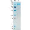 sp-pme100546 psma sp1