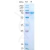 sp-pme100548 il15ra sp1