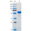 sp-pme100570 s protein rbd sp1