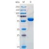 sp-pme100570 s protein rbd sp1