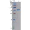 sp-pme100611 cxcl4 sp1