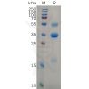 sp-pme100637 tslp sp1