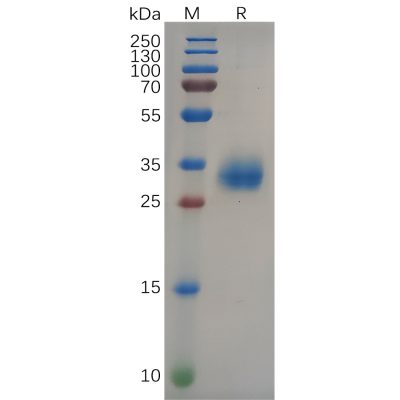 sp-pme100647 s protein rbd sp1