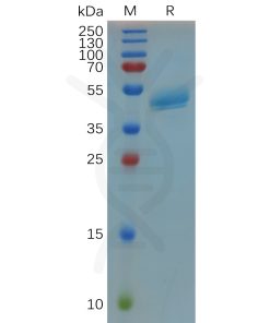 sp-pme100671 rspo3 sp1