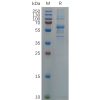 sp-pme100687 s protein rbd sp1