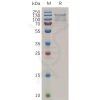 sp-pme100723 tem1 sp1