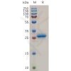 sp-pme100724 mesothelin sp1