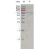 sp-pme100765 timp4 sp1