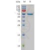 sp-pme100769 fgf21 sp1