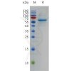 sp-pme100772 s protein rbd sp1