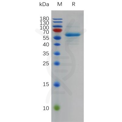 sp-pme100772 s protein rbd sp1